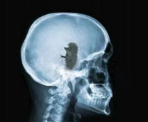 ��� ��� �� ������?