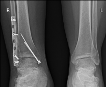 ������� ����. ��� ������� � ��� ����